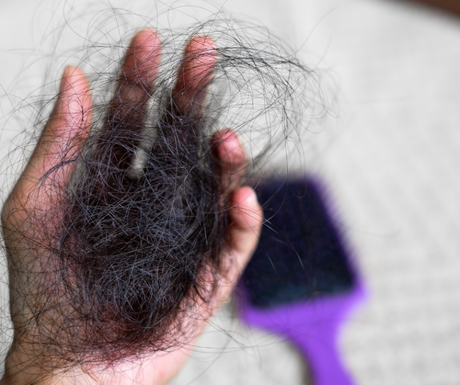 Haaruitval bij vrouwen en hormonen: oorzaken, signalen en wat je eraan kunt doen